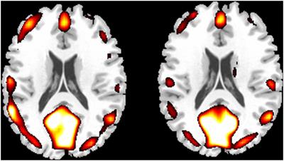 Training-Specific Changes in Regional Spontaneous Neural Activity Among Professional Chinese Chess Players